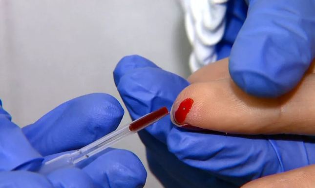 SUS inclui teste rápido para dengue e chikungunya